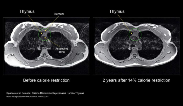 Thymus Calorie Restriction