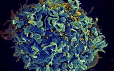 درمان بیماری اچ آی وی بدون دارو، کشف جدید محققان