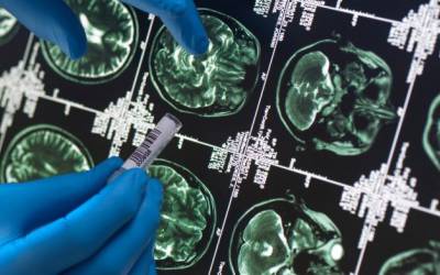 جزئیات ترسناکی در مورد بیماری مرموز مغزی